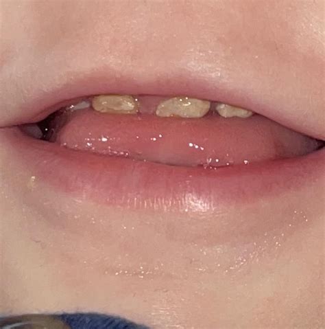 What is going on : r/askdentists .